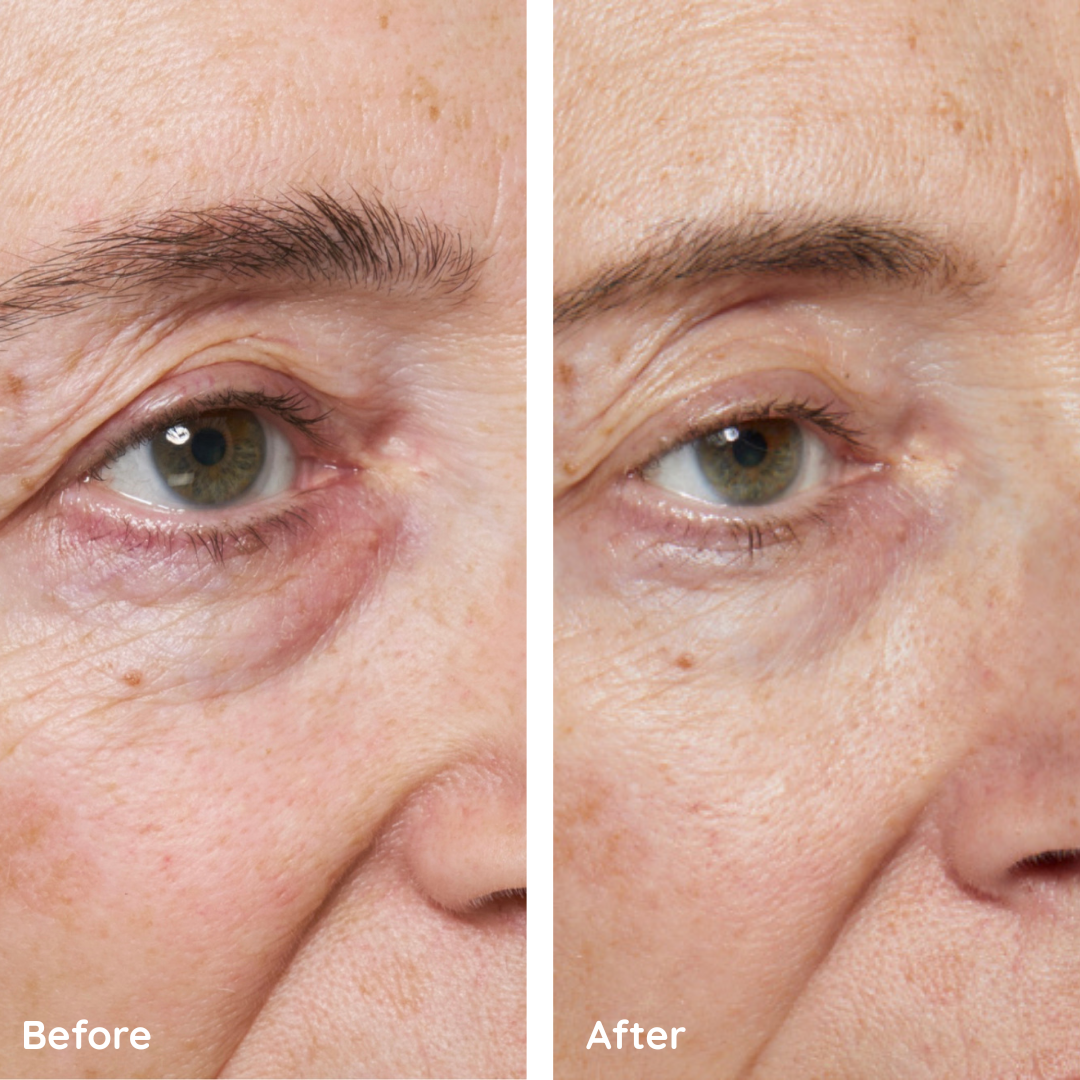 The Peptide Collagen Hydrogel Eye Patch